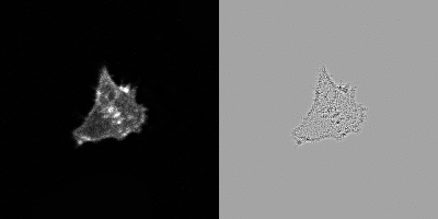 ../../_images/actin_laplacian_filter.png
